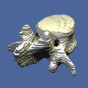 Vertebra (side length: 179 voxels). Volume courtesy of ..